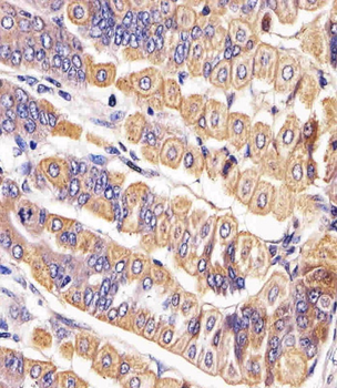 Ror2 Antibody (C-term)