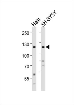 Ror2 Antibody (C-term)