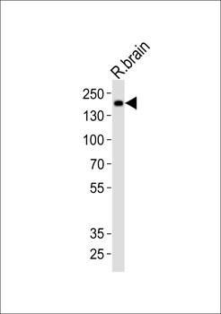 Insrr Antibody (C-term)