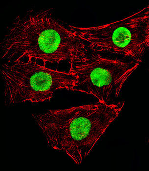 Hmga2 Antibody (C-term)