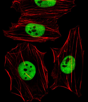 Smarcc1 Antibody (C-term)