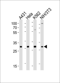 CDK5 Antibody (C-term)