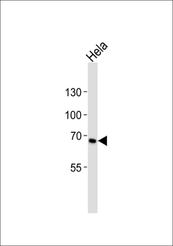 TNFRSF8 Antibody (N-term)