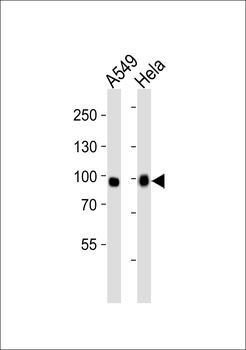 Fgfr3 Antibody (Center)