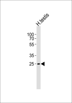 STPG1 Antibody (C-term)