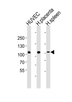 GP1BAB (Glycocalicin) Antibody (Center)