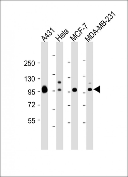HUMAN-CTNND1_isform 2ABC(Y174) Antibody