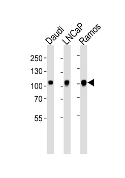 MME Antibody (N-term)