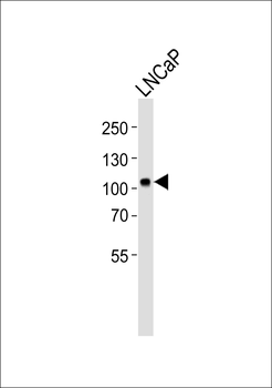 MME Antibody (N-term)