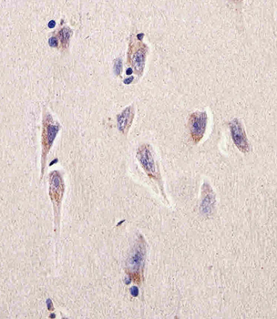 DHFR Antibody (N-term)