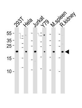 DHFR Antibody (N-term)