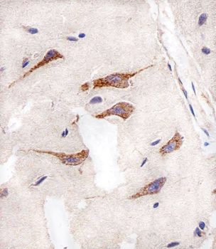 AURKA Antibody