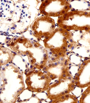 FBXL17 Isoform 2 Antibody (C-term)