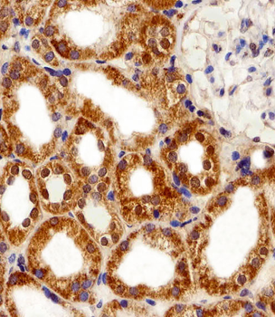 FBXL17 Isoform 2 Antibody (C-term)