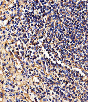 HLA-B Antibody (N-term)