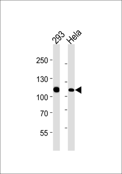 MSH2 Antibody (Center)