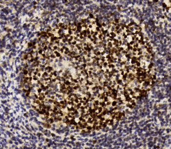 MSH2 Antibody (Center)