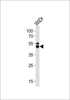 KRT20 Antibody (C-term)