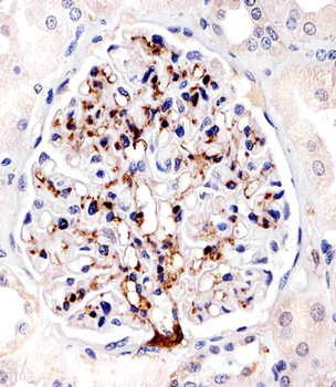 FABP4 Antibody