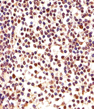 PCNA Antibody (C-term) [Knockout Validated]
