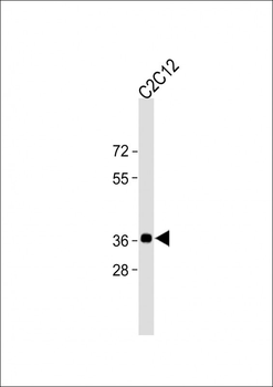 PCNA Antibody (C-term) [Knockout Validated]