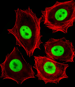 R Cdk4 Antibody (C-term)
