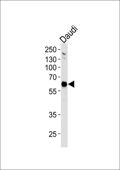 USP22 Antibody (C-term)