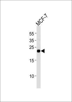 MGMT Antibody