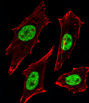 MGMT Antibody