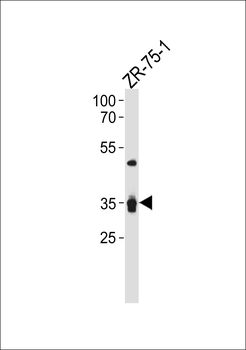 IL3RA Antibody (C-term)