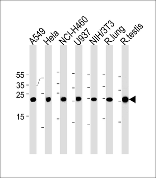 Cebpd Antibody (Center)