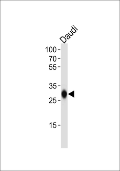 HLA-DQB1 Antibody (N-term)