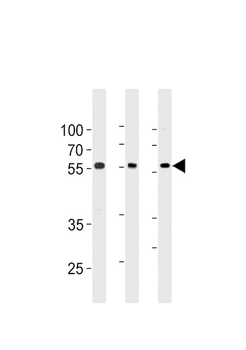 TRIM6 Antibody (N-term)