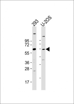 TRIM6 Antibody (N-term)