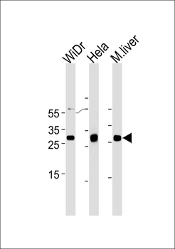 CDX1 Antibody (C-term)