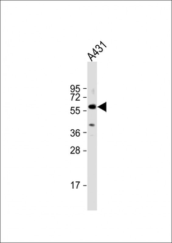 TGFBR1 Antibody (Center)