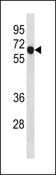 CCNB1 Antibody (C-term T321)