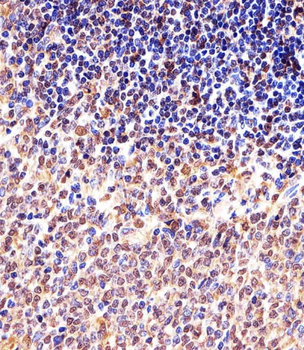 M CCNB1 Antibody (Center S123/S125)