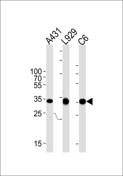 CCND1 Antibody (C-term T286)