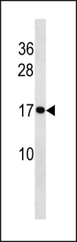 HIST1H3/2H3/3H3/H3F3 Antibody (C-term)