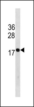 HIST1H3/2H3/3H3/H3F3 Antibody (C-term)