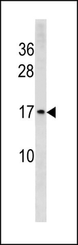 HIST1H3/2H3/3H3/H3F3 Antibody (N-term)