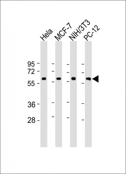 TP53 Antibody (N-term)