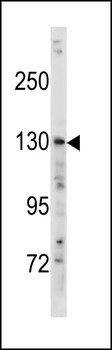 TSC1 Antibody (Center T417)