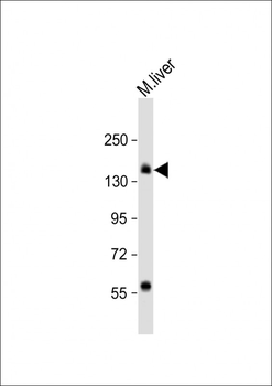 Mouse TSC1 Antibody (C-term S1138)
