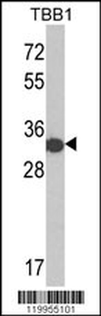 His Tag Antibody