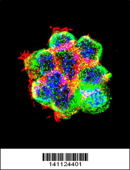 CTNNB1 Antibody (C-term)