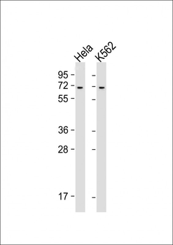 YTHD3 Antibody (Center)