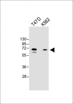 YTHD3 Antibody (Center)