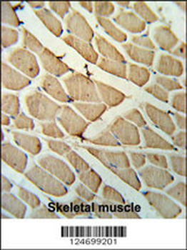 YTHD3 Antibody (Center)